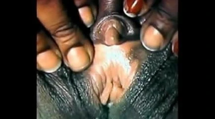 The Clitoris
