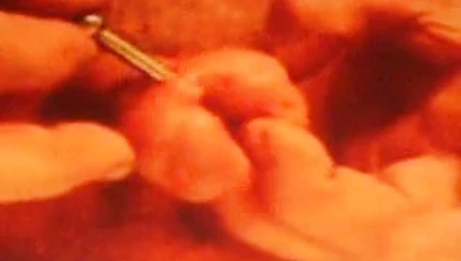 penis