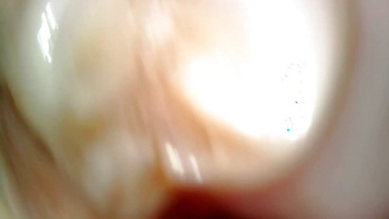 Medical Endoscope Oral Exam: Gummy Chewing, Extreme Teeth & Tongue Macro