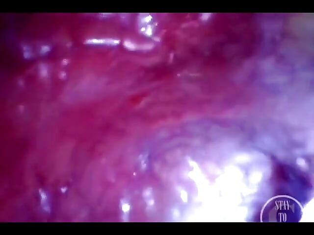 POV Extreme Deep Anal Exploration! Fast Visible Heartbeat