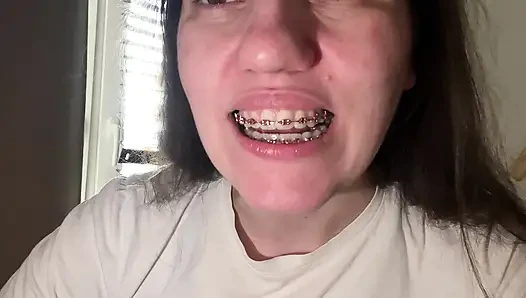 Licking Your Braces with Your Tongue