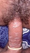 Pratinjau video