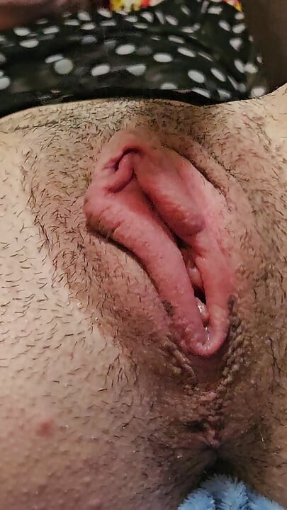 Azotar caliente