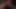 Bdsm verbruhte haut - episode 1