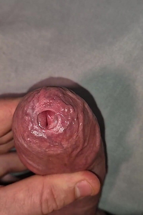 Close up on Phimosis Large Cock, so Hot!