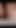 My crazy video - gyno exam. Speculum in my asshole | Clip 1