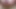 Lizzy Yum January 2023 #26 lizzy jacket post op pussy masturbation orgasm