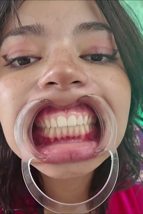 לחיים נמשכות הצידה שיניים חשופות