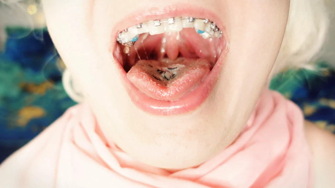 BRACES fetish - ASMR video of eating MUKBANG...