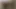 LizzyYum december 20 2023 Post Op Orgasm Pussy Masturbation Teasing
