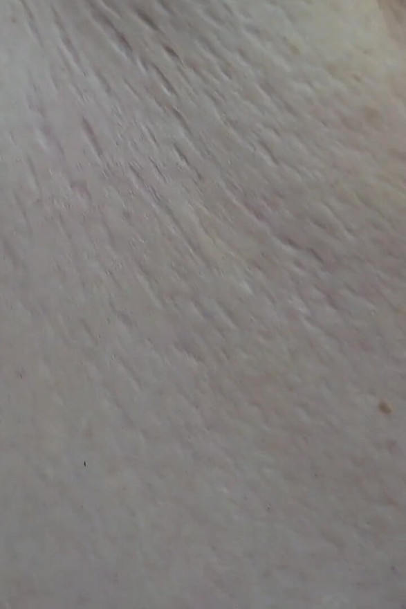 SSBBW up Close Body Exploration Stretch Marks