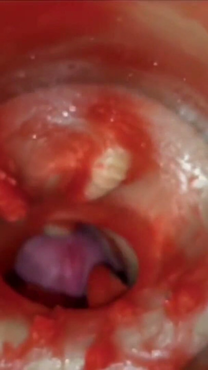 Cumfeti Dripping Creampie Compilation- Endoscopy view | Clip 1