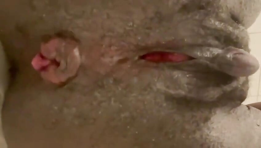 Self Anal Check