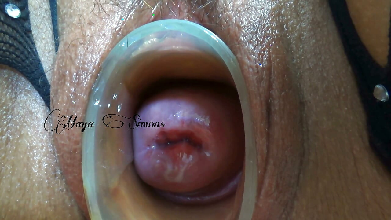 This Is What My Cervix Looks Like After a Year Without Seeing It