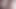 Masturbation Anal