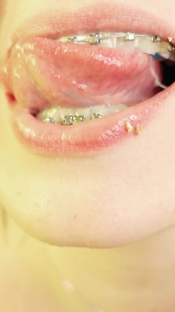 Key moment from "eating in braces - vore and food fetish - close up video"