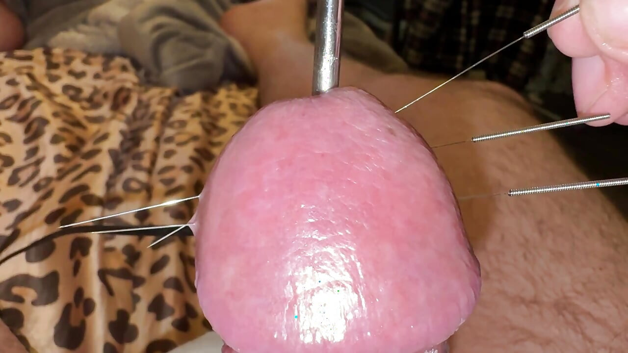 Needles through the hard glans!