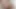 LizzyYum January 2024 ANAL DILATING Post Op Orgasm Pussy anal Masturbation Teasing