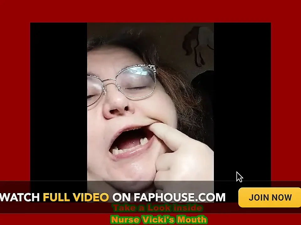 Requested Video Look Inside My Mouth