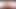 D.Va Fotoğraf Çekimi