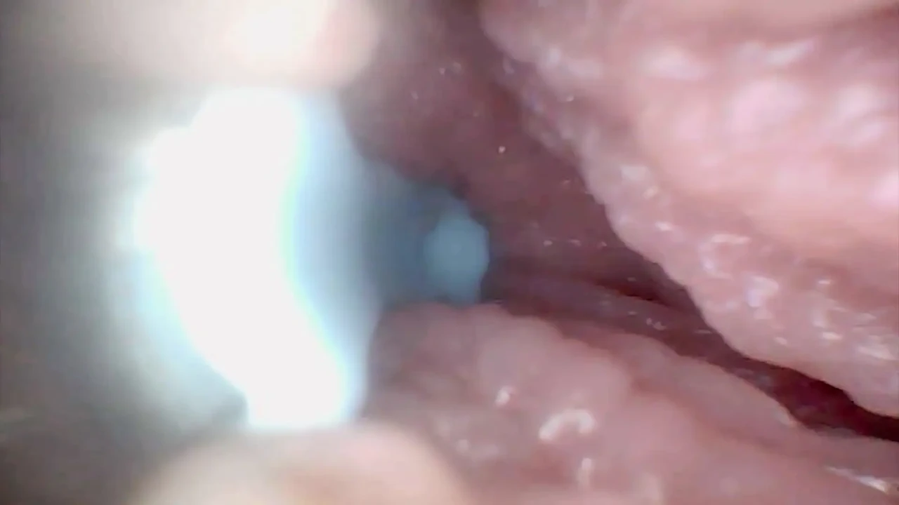 Let's Take a Peek Into My Juicy Pussy Together (endoscope Camera)