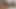 Militärhormone werden mit einem Mädchen bisexuell