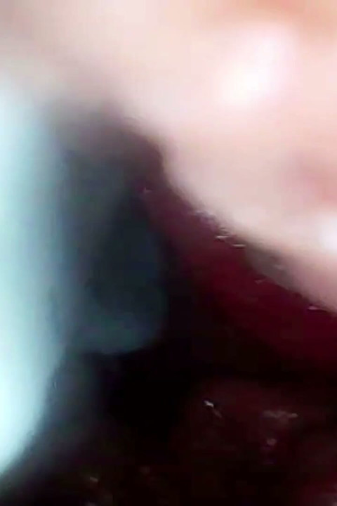 La Cámara De Endoscopio Graba El Punto G De Mi Esposa. Video Educativo De Cerca