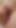 Hairy balls and anal hole