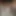 18yo Tiktok Thot's Pussy Explodes on Camera! Uncensored Gape