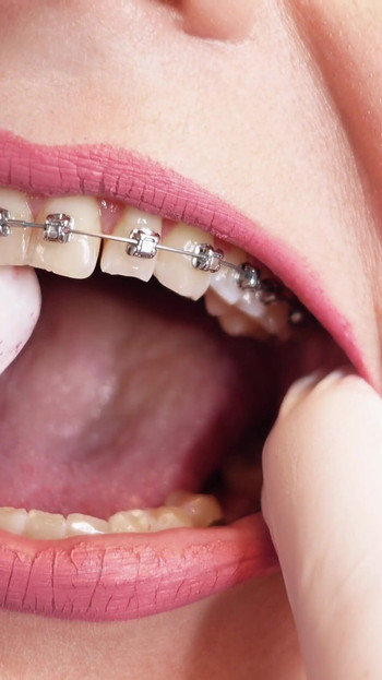 Must-see moment from "ASMR video: hot BRACES and double layer of medical nurse nitrile gloves (Arya Grander)"