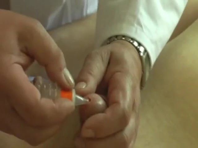 Catheter