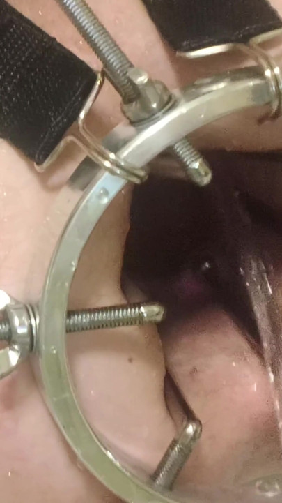 Enema, anal shower. Close-up view through anal mirror. Anal with water. Filling anal with water | Clip 1