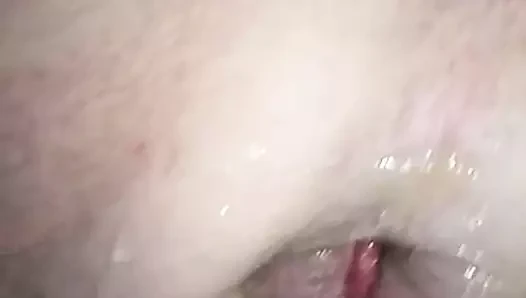 Large asshole