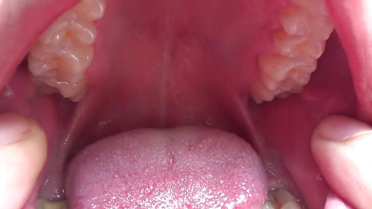 Kate open her mouth wide for you