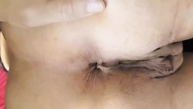 I need suckers