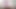Teen Has First BBC