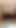 Unforgettable moment from "Doctor girlfriend enjoys fucking cowgirl style with Indian big cock on patient's bed, Hindi porn"