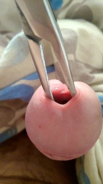 Insertion urethra open1 no snapcat