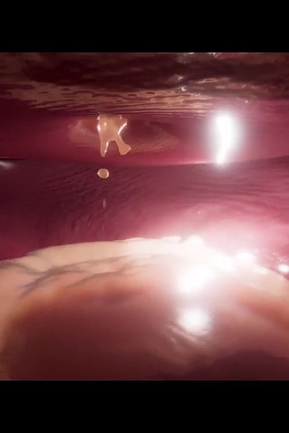 Stojeća igra (standardna - rendgenska snimka)