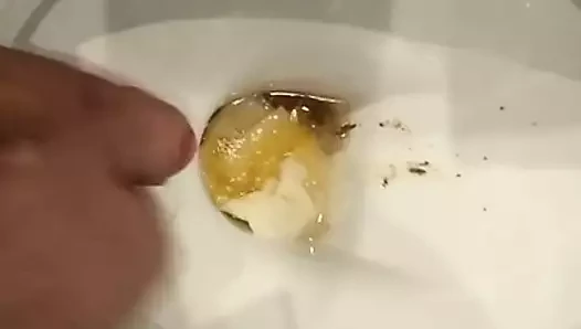 Sperm