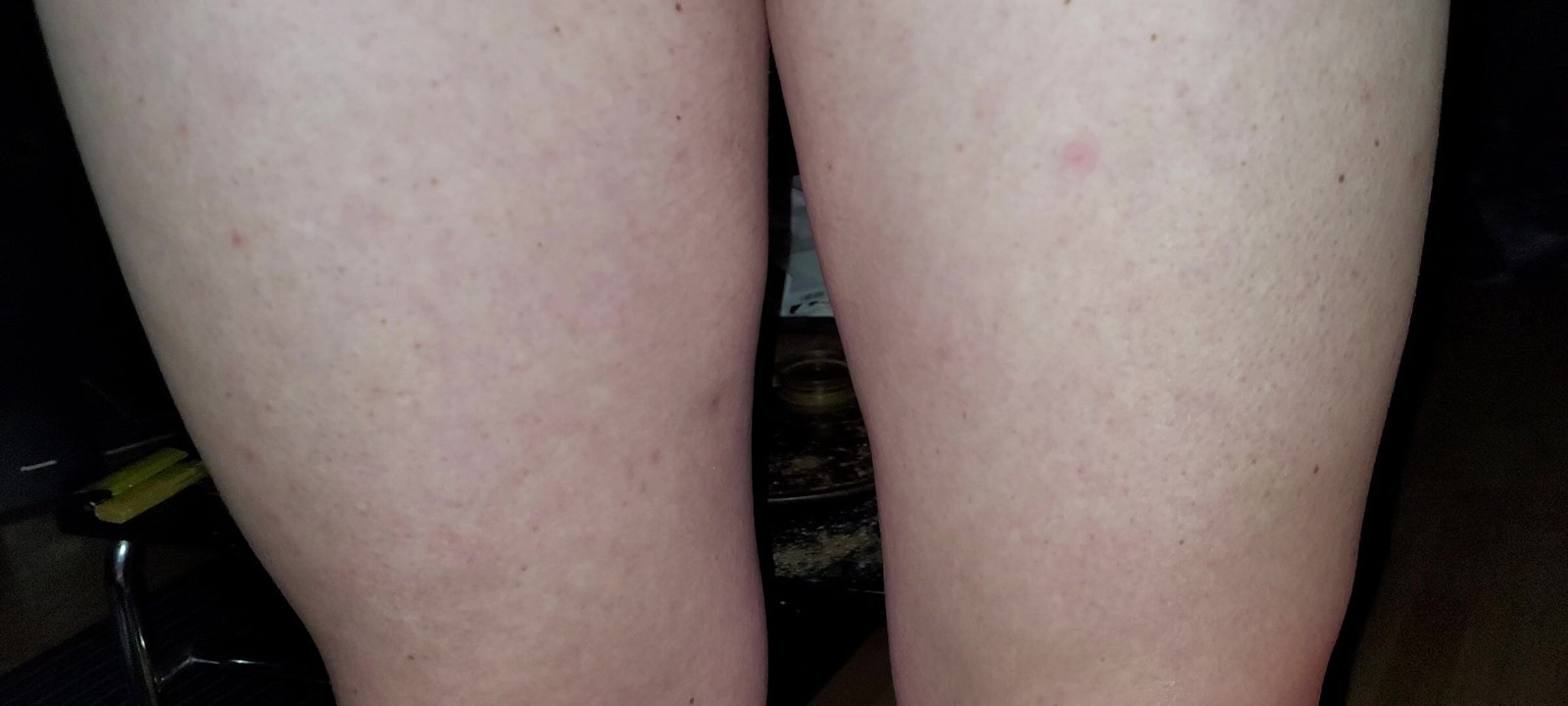 Small penis