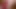 An exciting and big prolapse falls out of the ass of a young and hot guy who demonstrates it on a phone camera