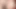 Nose Wide Open. Sümük damlatıyor. Bakış açısıyla hapşırdır ve yüzüne yaşlar akıyor.