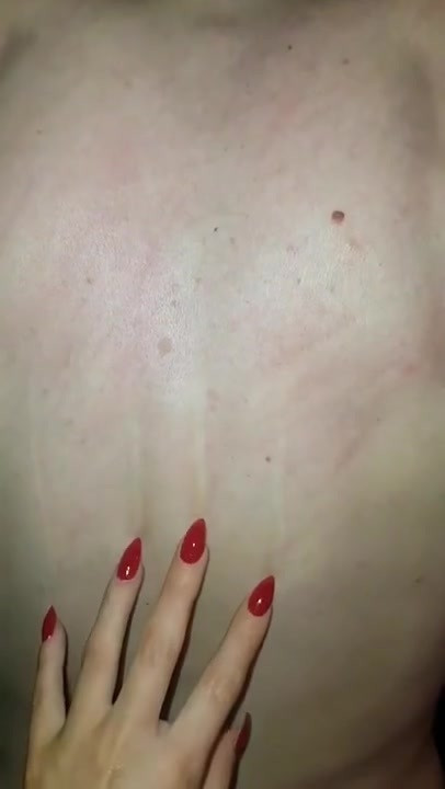 Backscratch
