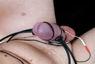 Precum dengan e-stimul