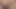 Mature Woman's Huge Clit