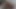 Lizzy Yum VR APRIL 2025 post op Solo Masturbation, dilate, bathing, orgasm, anal, sextoys, edging #2