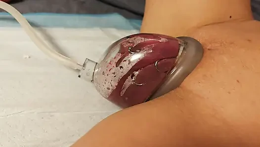 Extremely pumped pussy