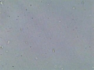 Swimming Sperm
