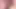 Micro penis cum over flow